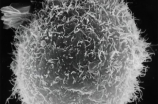 异型淋巴细胞是什么？异型淋巴细胞若何影响我们的免疫反映？